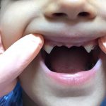 Dr Loh 14 - کلینیک دندانپزشکی دکتر سهیل سالاری و دکتر شقایق لوح