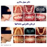 Dr Salari Before After 1 - کلینیک دندانپزشکی دکتر سهیل سالاری و دکتر شقایق لوح