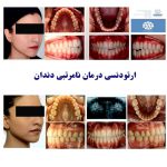 Dr Salari Before After 2 - کلینیک دندانپزشکی دکتر سهیل سالاری و دکتر شقایق لوح