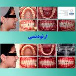 Dr Salari Before After 3 - کلینیک دندانپزشکی دکتر سهیل سالاری و دکتر شقایق لوح
