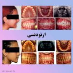 Dr Salari Before After 5 - کلینیک دندانپزشکی دکتر سهیل سالاری و دکتر شقایق لوح
