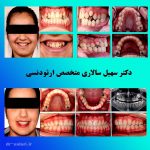 Dr Salari Before After 7 - کلینیک دندانپزشکی دکتر سهیل سالاری و دکتر شقایق لوح