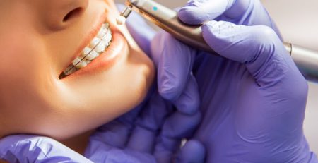 تکنولوژی های جدید ارتودنسی دندان