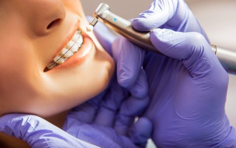 تکنولوژی های جدید ارتودنسی دندان