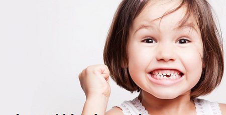 عصب کشی دندان شیری چه اهمیتی دارد؟
