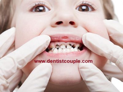 عکس رادیولوژی دندان کودک واقعا الزامی است؟