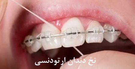 نخ دندان ارتودنسی
