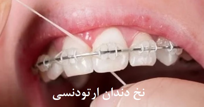 نخ دندان ارتودنسی