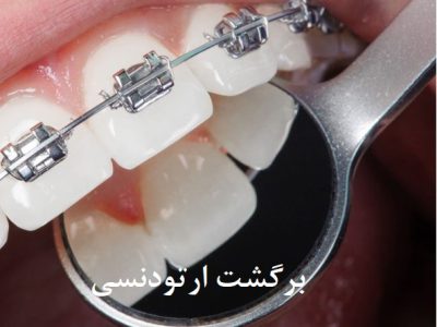 dis teli 2 - کلینیک دندانپزشکی دکتر سهیل سالاری و دکتر شقایق لوح